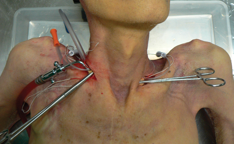 Photo 02. fig.2
